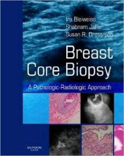 Breast Core Biopsy: A Pathologic-Radiologic Approach (Original PDF from Publisher)