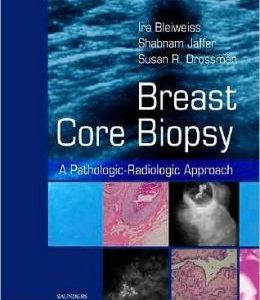 Breast Core Biopsy: A Pathologic-Radiologic Approach (Original PDF from Publisher)