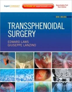Transsphenoidal Surgery