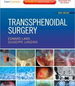 Transsphenoidal Surgery