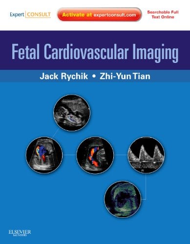 Fetal Cardiovascular Imaging: A Disease Based Approach (Videos, Organized)