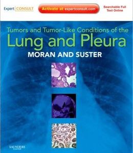 Tumors and Tumor-Like Conditions of the Lung and Pleura (ORIGINAL PDF from Publisher)