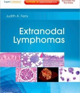 Extranodal Lymphomas (ORIGINAL PDF from Publisher)