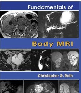 Fundamentals of Body MRI (ORIGINAL PDF from Publisher)