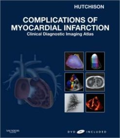Complications of Myocardial Infarction: Clinical Diagnostic Imaging Atlas (ORIGINAL PDF from Publisher)