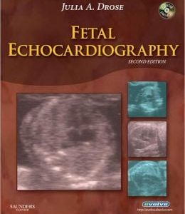 Fetal Echocardiography, 2nd Edition (Original PDF from Publisher)