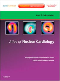 Atlas of Nuclear Cardiology: Imaging Companion to Braunwald’s Heart Disease (Original PDF from Publisher)