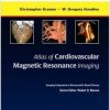 Atlas of Cardiovascular Magnetic Resonance Imaging: Expert Consult – Online and Print: Imaging Companion to Braunwald’s Heart Disease (Original PDF from Publisher)