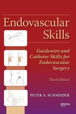 Endovascular Skills: Guidewire and Catheter Skills for Endovascular Surgery, Third Edition (PDF)