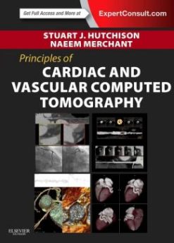 Principles of Cardiac and Vascular Computed Tomography (EPUB)