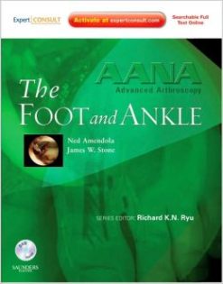 AANA Advanced Arthroscopy: The Foot and Ankle