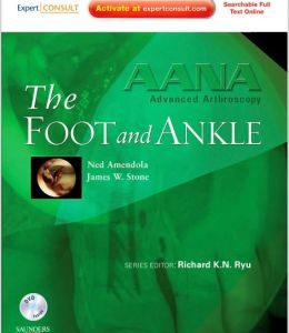 AANA Advanced Arthroscopy: The Foot and Ankle