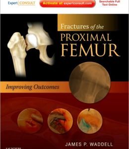 Fractures of the Proximal Femur: Improving Outcomes