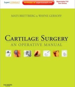 Cartilage Surgery: An Operative Manual