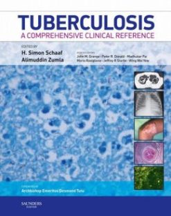 Tuberculosis: A Comprehensive Clinical Reference (ORIGINAL PDF from Publisher)