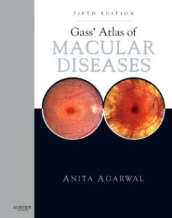 Gass’ Atlas of Macular Diseases: 2-Volume Set, 5th Edition