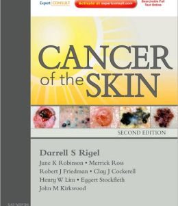 Cancer of the Skin, 2nd Edition