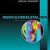 Musculoskeletal MRI, 2nd Edition (Original PDF from Publisher)