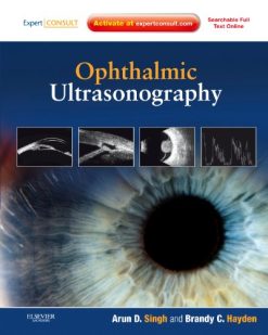 Ophthalmic Ultrasonography (Videos Only, Well Organized)