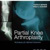 Partial Knee Arthroplasty: Techniques for Optimal Outcomes (Original PDF from Publisher)