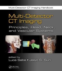 Multi-Detector CT Imaging: Principles, Head, Neck, and Vascular Systems