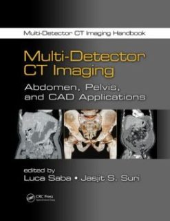 Multi-Detector CT Imaging: Abdomen, Pelvis, and CAD Applications (ORIGINAL PDF from Publisher)