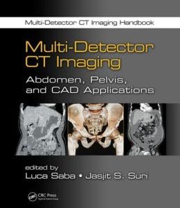 Multi-Detector CT Imaging: Abdomen, Pelvis, and CAD Applications (ORIGINAL PDF from Publisher)