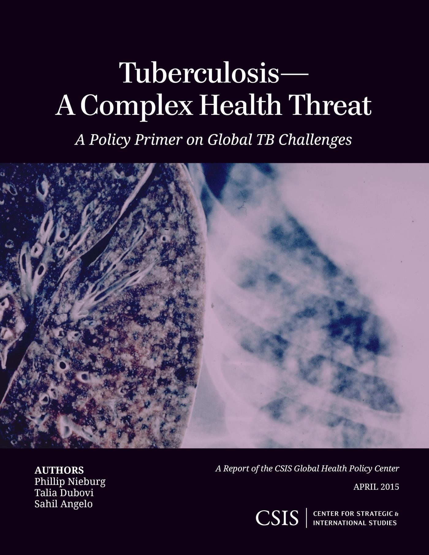 Tuberculosis-A Complex Health Threat: A Policy Primer of Global TB Challenges (Original PDF from Publisher)