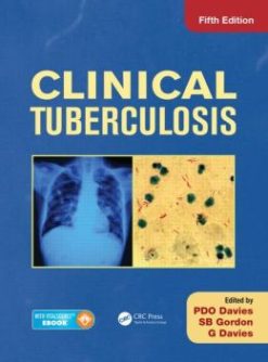 Clinical Tuberculosis, Fifth Edition
