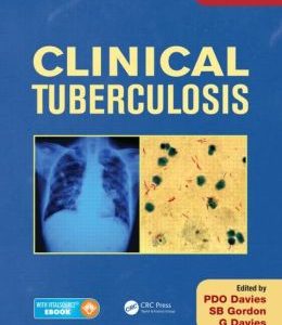 Clinical Tuberculosis, Fifth Edition