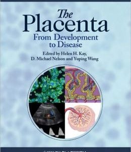 The Placenta: From Development to Disease