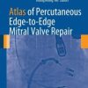 Atlas of Percutaneous Edge-To-Edge Mitral Valve Repair (Original PDF from Publisher)