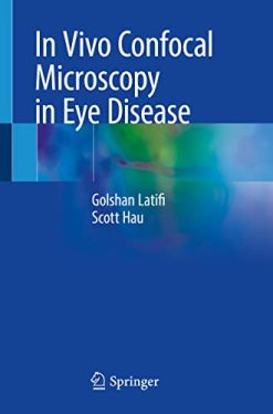 In Vivo Confocal Microscopy in Eye Disease (Original PDF from Publisher)