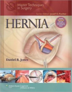 Master Techniques in Surgery: Hernia (ORIGINAL PDF from Publisher)