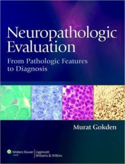 Neuropathologic Evaluation: From Pathologic Features to Diagnosis (ORIGINAL PDF from Publisher)