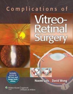 Complications of Vitreo-Retinal Surgery (ORIGINAL PDF from Publisher)