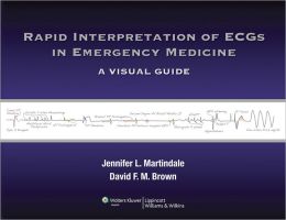 Rapid Interpretation of ECGs in Emergency Medicine: A Visual Guide (ORIGINAL PDF from Publisher)