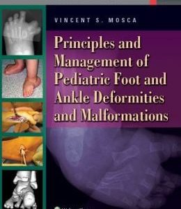Principles and Management of Pediatric Foot and Ankle Deformities and Malformations (EPUB)