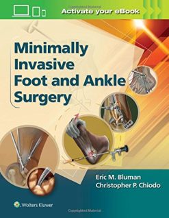 Minimally Invasive Foot & Ankle Surgery (Minimally Invasive Orthopaedic Surgery) (EPUB)