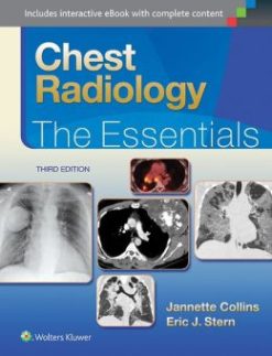 Chest Radiology: The Essentials, 3rd Edition (EPUB)