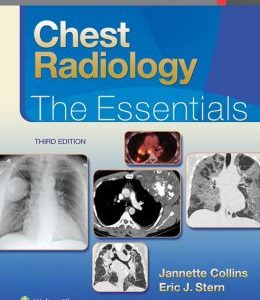 Chest Radiology: The Essentials, 3rd Edition (EPUB)