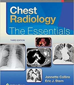 Chest Radiology: The Essentials, 3rd Edition (Original PDF from Publisher)