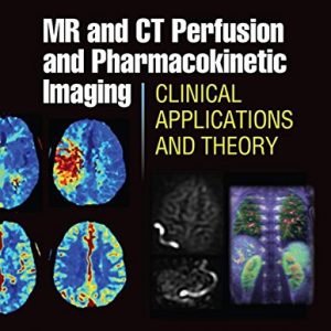 MR and CT Perfusion and Pharmacokinetic Imaging: Clinical Applications and Theoretical Principles (EPUB)