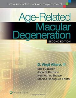 Age-Related Macular Degeneration, 2nd Edition (EPUB)