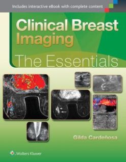 Clinical Breast Imaging: The Essentials (EPUB)