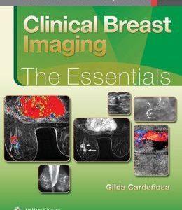 Clinical Breast Imaging: The Essentials (EPUB)