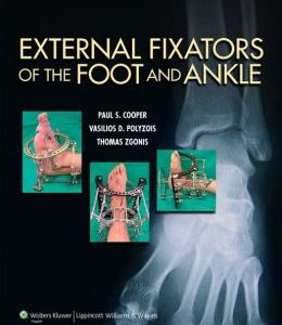 External Fixators of the Foot and Ankle (ORIGINAL PDF from Publisher)