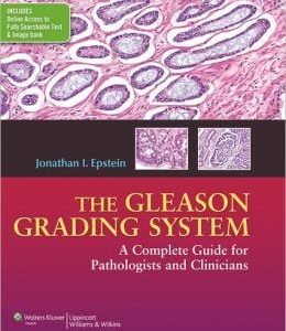 The Gleason Grading System: A Complete Guide for Pathologist and Clinicians (Original PDF from Publisher)