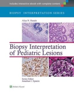 Biopsy Interpretation of Pediatric Lesions (EPUB)