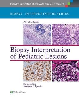 Biopsy Interpretation of Pediatric Lesions (EPUB)
